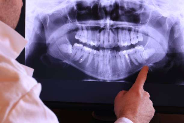 Best Emergency Treatment for Toothache in Linton Hall, VA