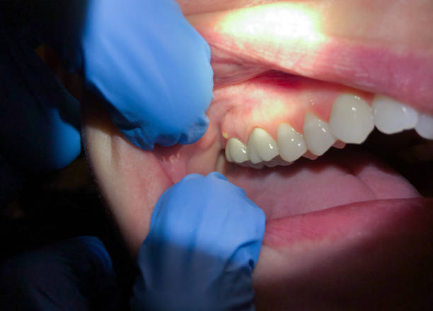 Best Same-Day Emergency Dentist in Linton Hall, VA