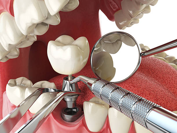 Best Same-Day Emergency Dentist in Linton Hall, VA
