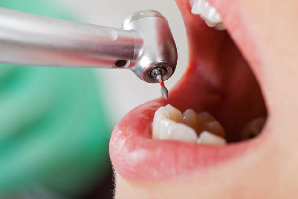 Best Emergency Treatment for Toothache in Linton Hall, VA